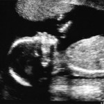 feb22_ultrasound1
