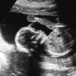 feb22_ultrasound5